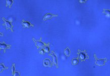 SARS-CoV-2 Spike Proteins Interacts With Platelet Integrins To Cause Deformities That Results In Coagulopathies