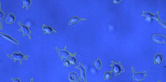 SARS-CoV-2 Spike Proteins Interacts With Platelet Integrins To Cause Deformities That Results In Coagulopathies