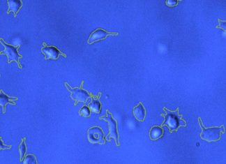 SARS-CoV-2 Spike Proteins Interacts With Platelet Integrins To Cause Deformities That Results In Coagulopathies