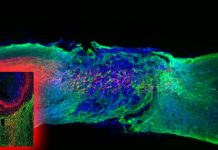 Vsx2 neurons are vital and sufficient for spinal cord stimulation therapies to be effective to restore motor function in those with spinal cord injury