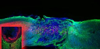 Vsx2 neurons are vital and sufficient for spinal cord stimulation therapies to be effective to restore motor function in those with spinal cord injury