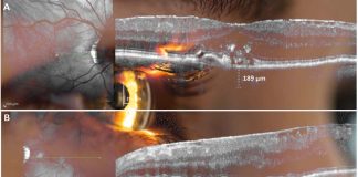 AI-enabled eye scans could be used to rapidly predict whether a person is at high risk of heart disease