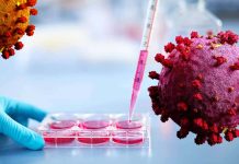 sHLA levels are significantly increased in COVID-19 patients