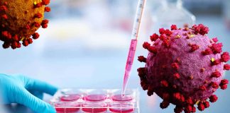 sHLA levels are significantly increased in COVID-19 patients