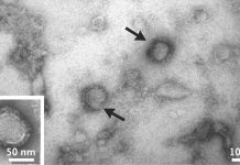 Novel Alongshan Virus (ALSV) Discovered In China In 2017 Now Found In Ticks In Switzerland