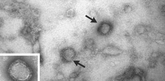 Novel Alongshan Virus (ALSV) Discovered In China In 2017 Now Found In Ticks In Switzerland