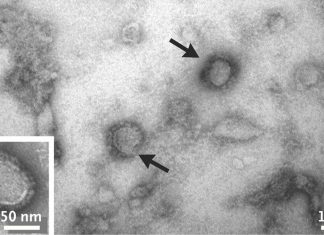 Novel Alongshan Virus (ALSV) Discovered In China In 2017 Now Found In Ticks In Switzerland