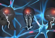 The pain-responsive neurons in the brain quiet down when receive touch input