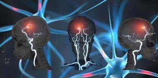 The pain-responsive neurons in the brain quiet down when receive touch input