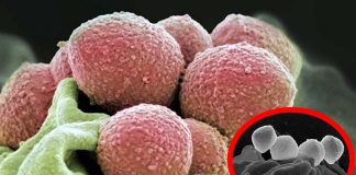 UK Health Authorities Issue Warnings About Rare Invasive Strep A Infection Outbreak After Six Children Died And More Than 851 Infected