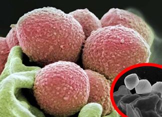 UK Health Authorities Issue Warnings About Rare Invasive Strep A Infection Outbreak After Six Children Died And More Than 851 Infected
