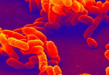 Canada: Haemophilus influenzae type B outbreak in Island Health