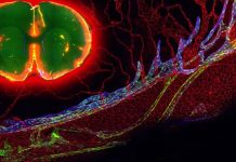 Arachnoid granulations – How the Human Brain Drains Fluid