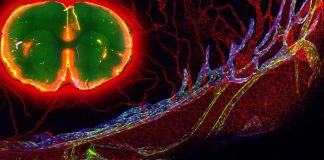 Arachnoid granulations – How the Human Brain Drains Fluid