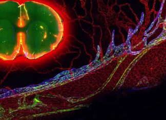Arachnoid granulations – How the Human Brain Drains Fluid