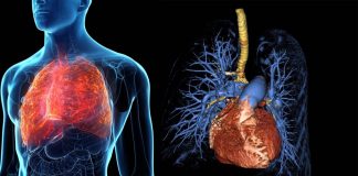 Pulmonary arterial hypertension is incurable but an experimental drug called SRT2104 may be effective