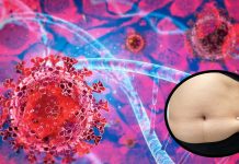 SARS-CoV-2 Has A Greater Affinity For Visceral Adipocytes