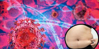 SARS-CoV-2 Has A Greater Affinity For Visceral Adipocytes