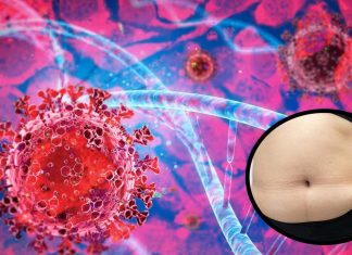SARS-CoV-2 Has A Greater Affinity For Visceral Adipocytes
