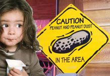 Il numero di bambini con allergie è più che raddoppiato negli ultimi 20 anni