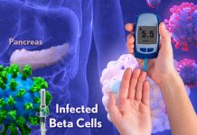 SARS-CoV-2 Exposure put at risk of new onset of Diabetes
