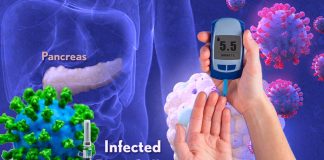 SARS-CoV-2 Exposure put at risk of new onset of Diabetes