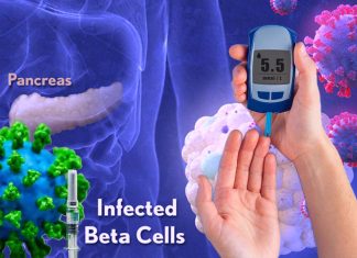 SARS-CoV-2 Exposure put at risk of new onset of Diabetes