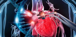 Dilated cardiomyopathy (DCM): CRISPR-Cas9 therapy can reverse the mutation
