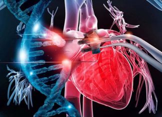 Dilated cardiomyopathy (DCM): CRISPR-Cas9 therapy can reverse the mutation