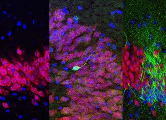 Oxytocin could promote the growth of new neurons to repair damaged tissue