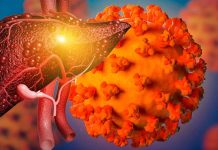 SARS-CoV-2 Can Cause Liver Impairment and Hypoalbuminemia