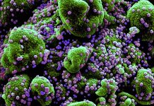 SARS-CoV-2 Infections Causes Alterations Of Circulating Peptidome In Human Host
