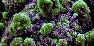 SARS-CoV-2 Infections Causes Alterations Of Circulating Peptidome In Human Host