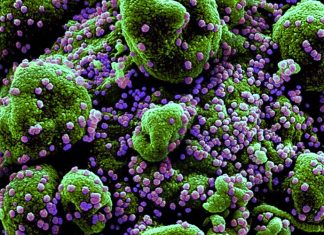 SARS-CoV-2 Infections Causes Alterations Of Circulating Peptidome In Human Host