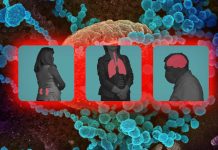 SARS-CoV-NSP2 Protein Enhances microRNA-Mediated Translational Repression With Serious Long Term Health Implications