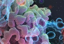Most COVID-19 patients display overt lymphopenia