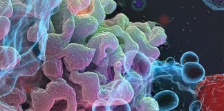 Most COVID-19 patients display overt lymphopenia