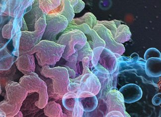 Most COVID-19 patients display overt lymphopenia