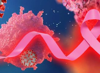 SARS-CoV-2 M Protein induce the proliferation and transformation of Breast Cancer Cells