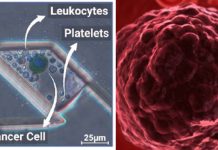 Researchers have developed a high throughput Static Droplet Microfluidic (SDM) device to detect Circulating Tumour Cells (CTCs)
