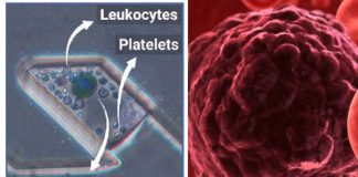 Researchers have developed a high throughput Static Droplet Microfluidic (SDM) device to detect Circulating Tumour Cells (CTCs)