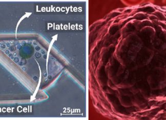 Researchers have developed a high throughput Static Droplet Microfluidic (SDM) device to detect Circulating Tumour Cells (CTCs)