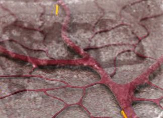 Post-COVID syndrome is associated with capillary alterations