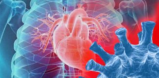 Cardiac fibrosis is yet another causative effect of exposure to the SARS-CoV-2 virus
