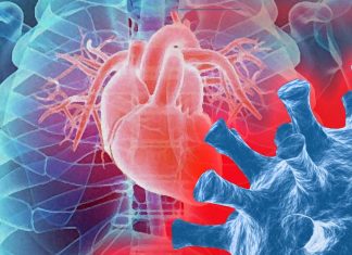 Cardiac fibrosis is yet another causative effect of exposure to the SARS-CoV-2 virus
