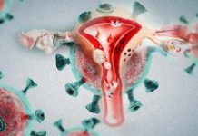 COVID-19 may have an indirect impact on cervical dysplasia