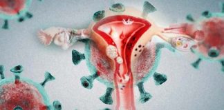 COVID-19 may have an indirect impact on cervical dysplasia