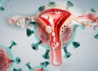 COVID-19 may have an indirect impact on cervical dysplasia