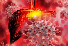 Liver injury may be associated with COVID-19 due to direct damage of the viral infection to liver cells up to 20 months after infection