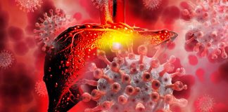 Liver injury may be associated with COVID-19 due to direct damage of the viral infection to liver cells up to 20 months after infection